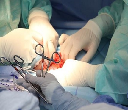 soft-tissue-surgery
